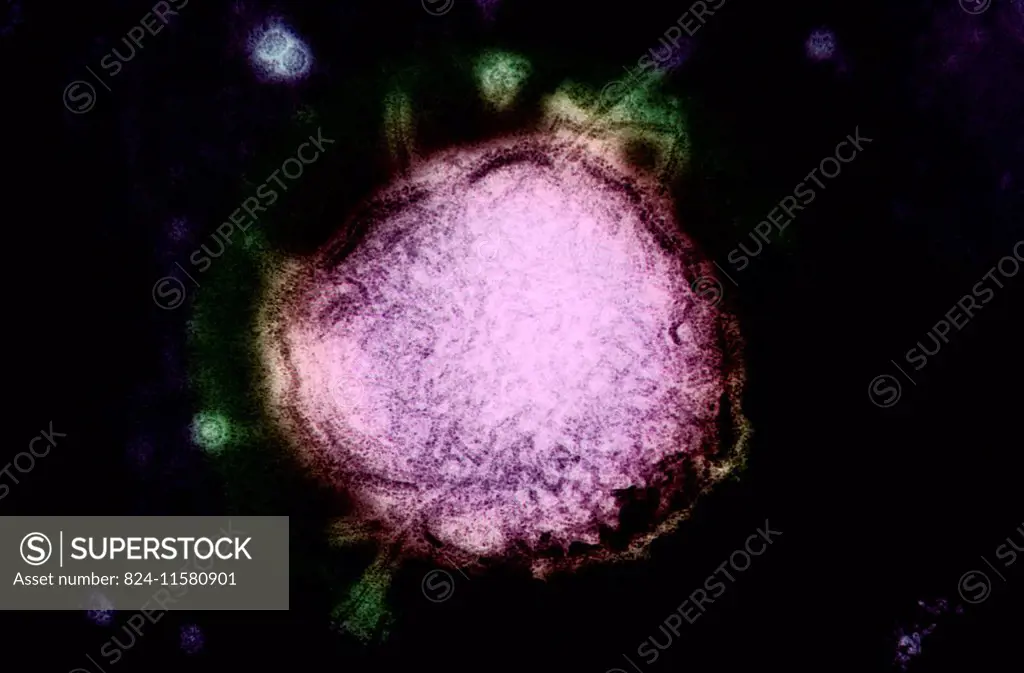 this electron micrograph reveals both a paramyxovirus measles virus, and virions of the polyomavirus, simian virus sv40 (smaller circles). the envelop...