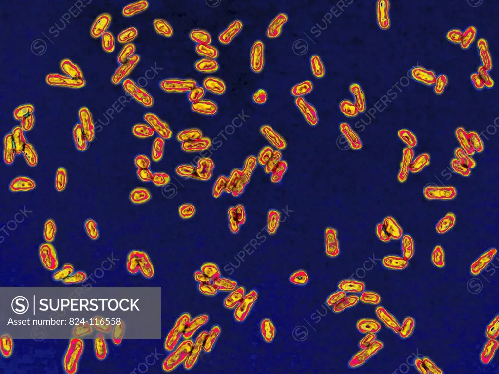 Dysentery bacillus shigella. This bacterium causes shigellosis, an infectious colitis characterised by an acute inflammatory reaction in the intestine...