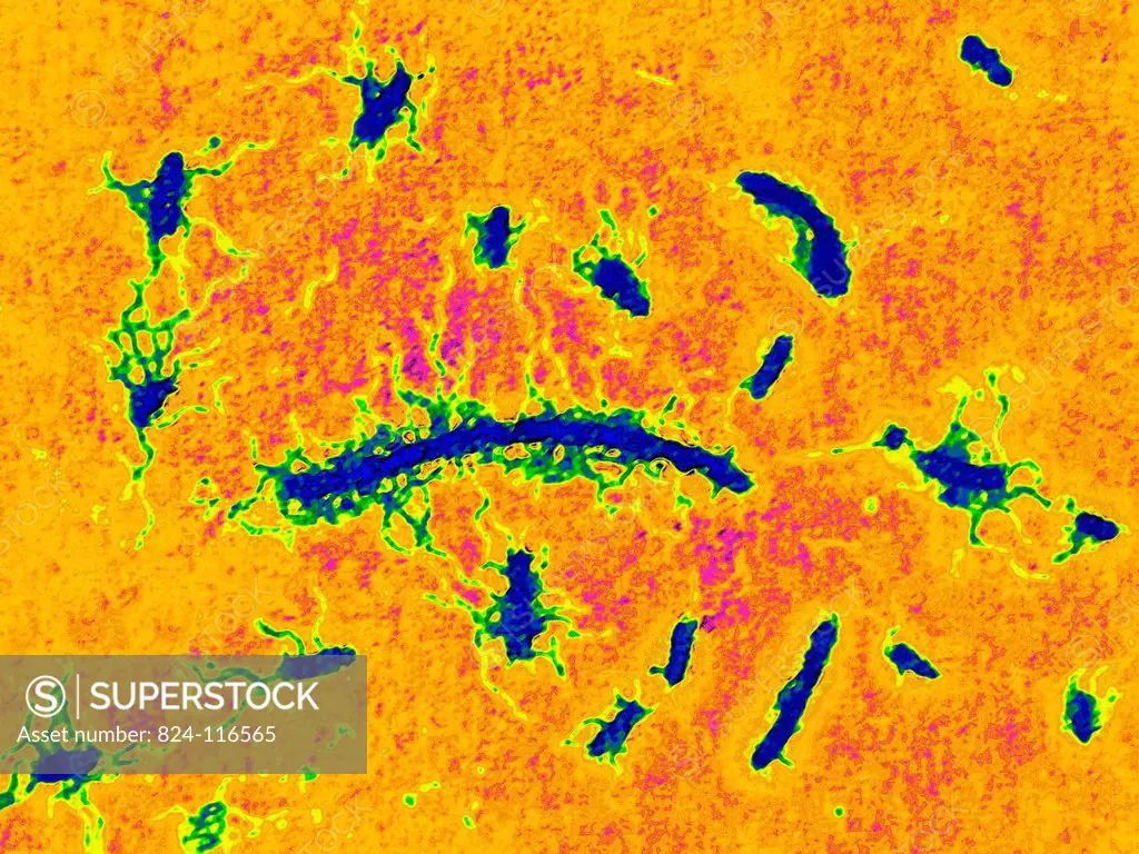 Typhoid bacillus, typhoid fever bacterium salmonella typhi. Optical microscopy x 1850.