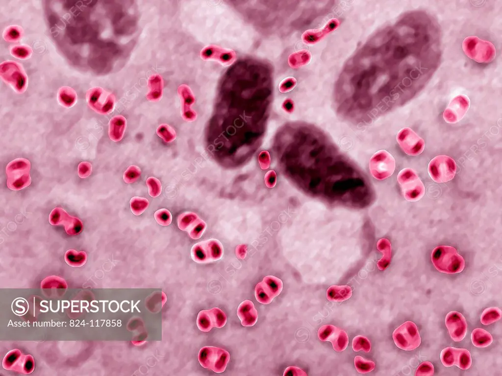 Pasteurella multocida or Pasteurella septical is the bacillus that causes infection in animal bites or scratches. After an incubation period of a few ...