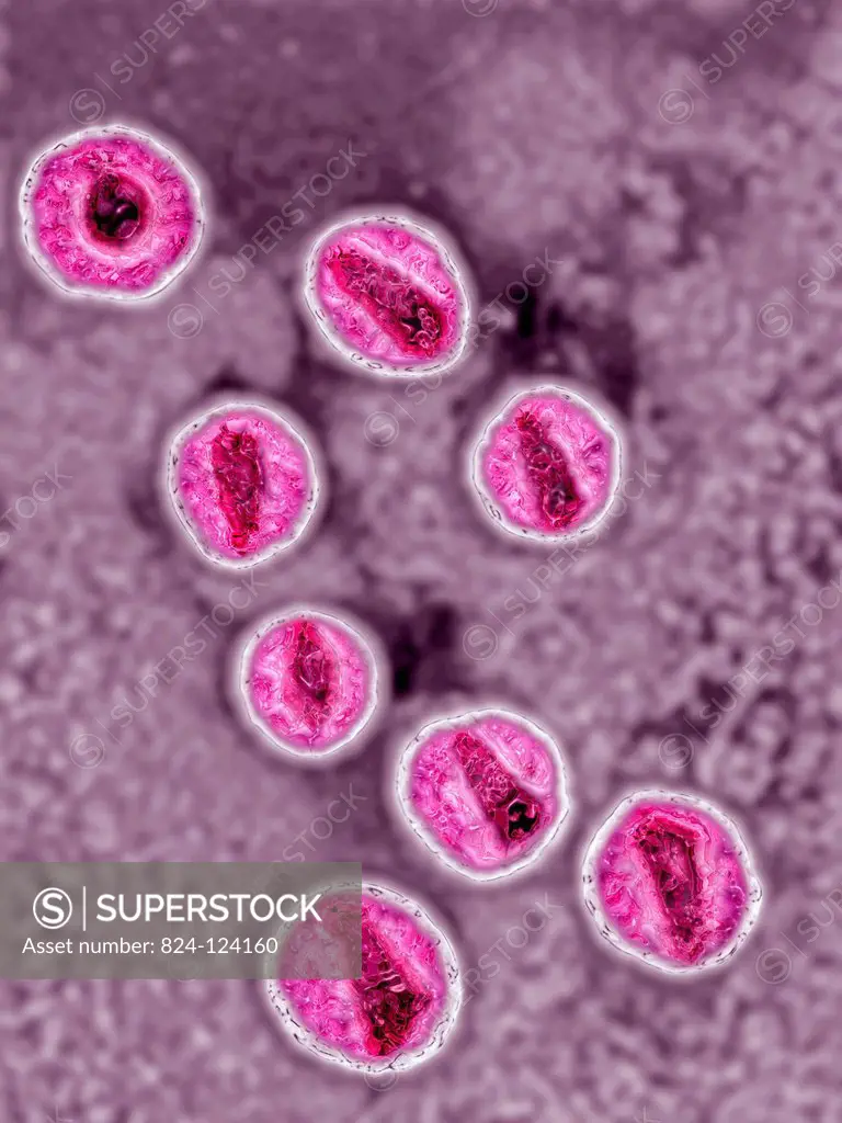 Retrovirus. Image produced using high-dynamic-range imaging (HDRI) from an image taken with transmission electron microscopy. Viral diameter ranges fr...