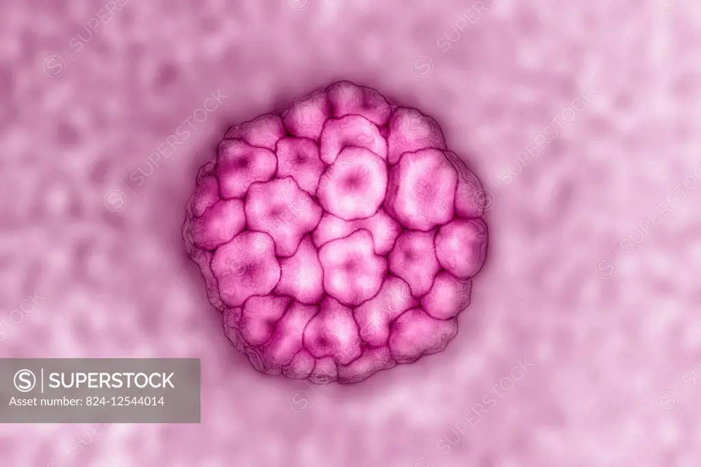 Human Papilloma virus (HPV). HPV causes STDs, condyloma acuminata warts that can lead to cervical cancer. It is also the cause of skin infections, war...