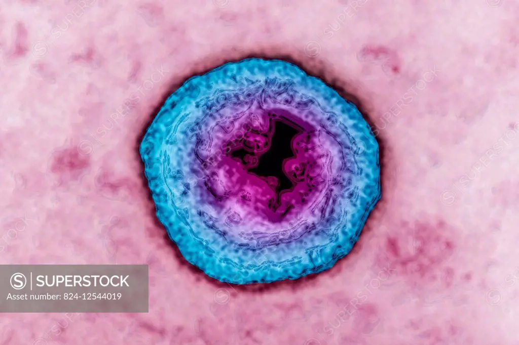 Herpes simplex virus (HSV). HSV causes cold sores and genital herpes. Image produced using high-dynamic-range imaging (HDRI) from an image taken with ...