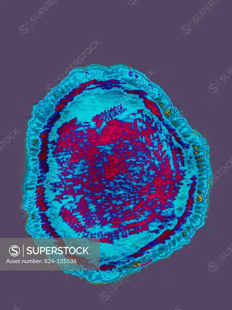 RSV Respiratory Syncytial Virus. Image produced using high-dynamic-range imaging (HDRI) from an image taken with transmission electron microscopy. Vir...