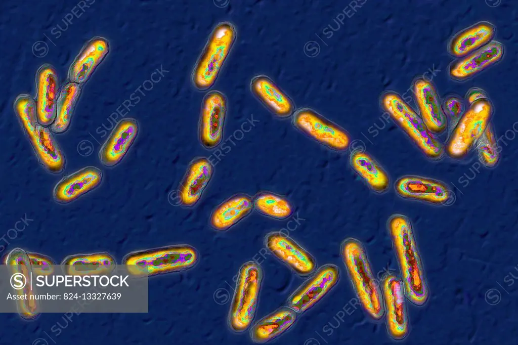 Clostridium difficile (bacteria responsible for hospital acquired diarrhoea) seen under optical microscopy.