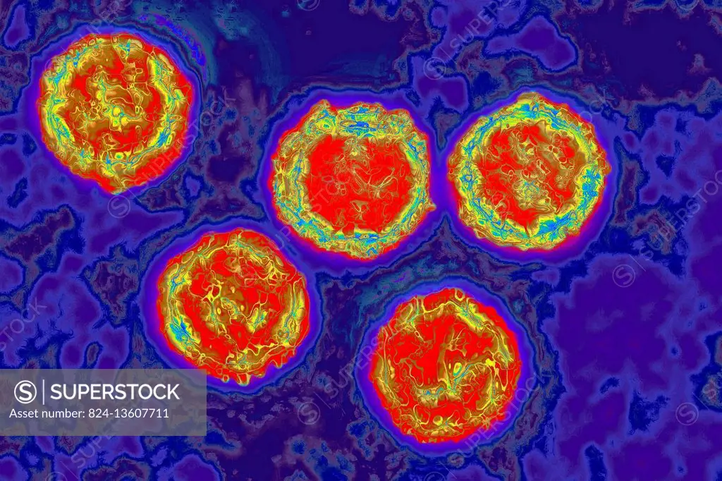 Human herpesvirus (HSV). Image taken with transmission electron microscopy. HSV 1 : causes orolabial herpes. HSV 2 : causes genital herpes. HSV 3 : ca...