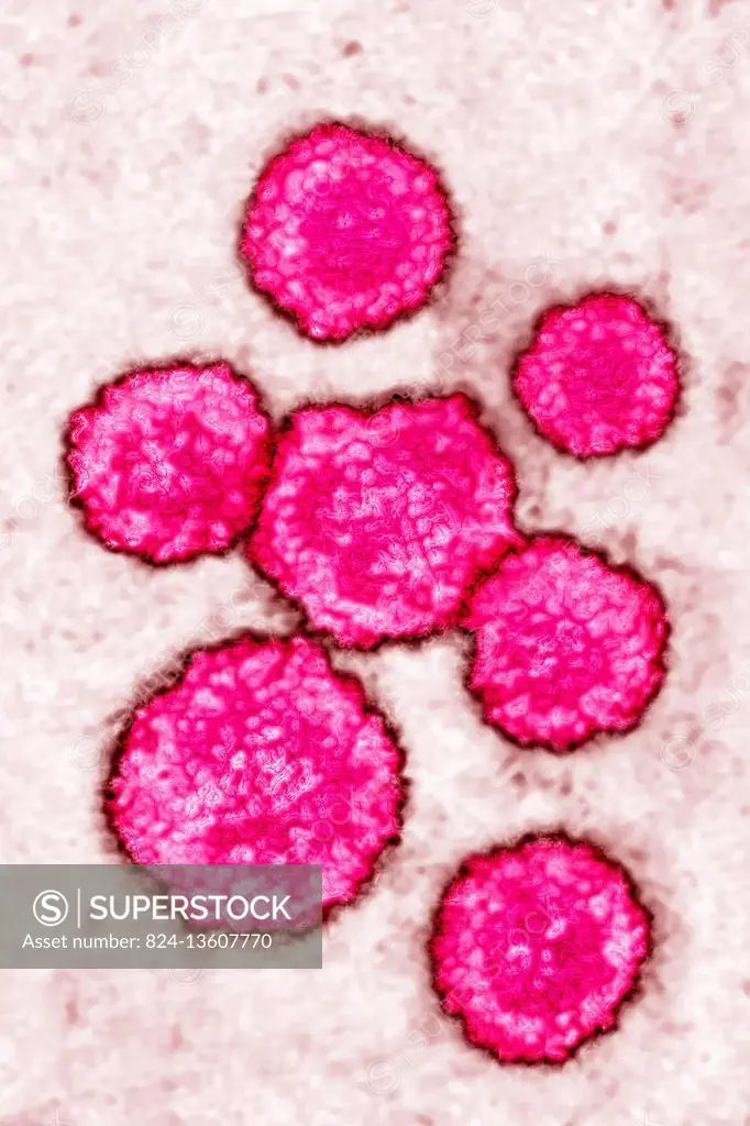 Rubella virus (rubivirus from the Togaviridae family). Image taken with transmission electron microscopy, (viral diameter around 50 to 70 nm).