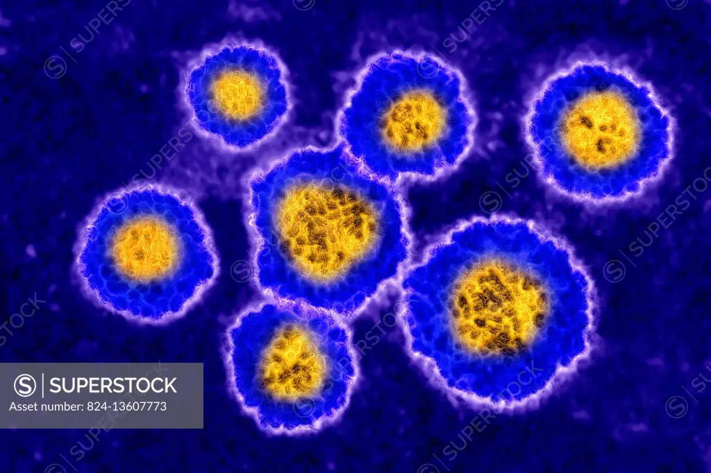 Rubella virus (rubivirus from the Togaviridae family). Image taken with transmission electron microscopy, (viral diameter around 50 to 70 nm).