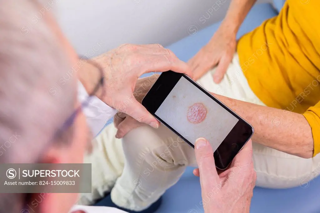 Doctor photographing skin lesions of a patient (psoriasis).