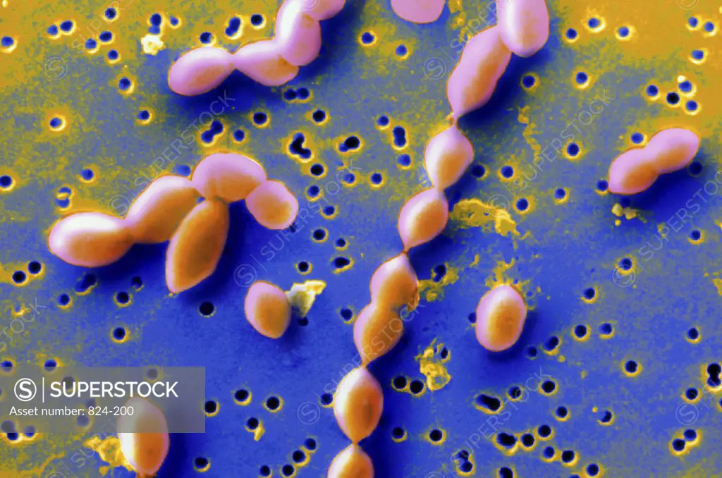 Pneumoccoccus Bacteria (Pneumonia Cells) 