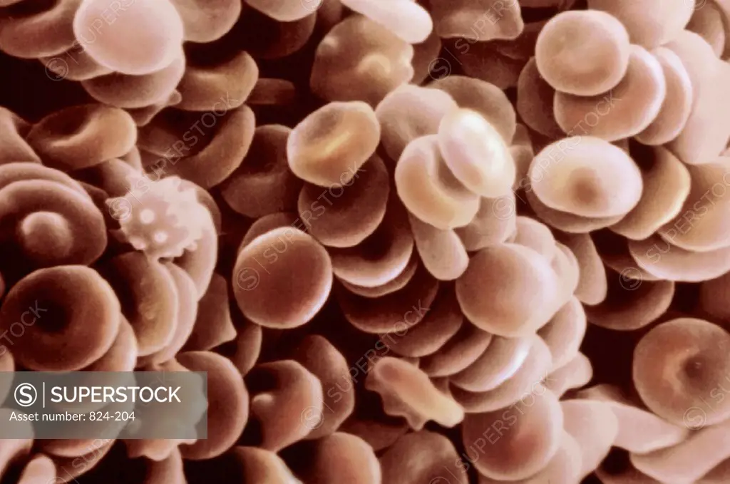 Hematology  Red Blood Cells Transporting Hemoglobin