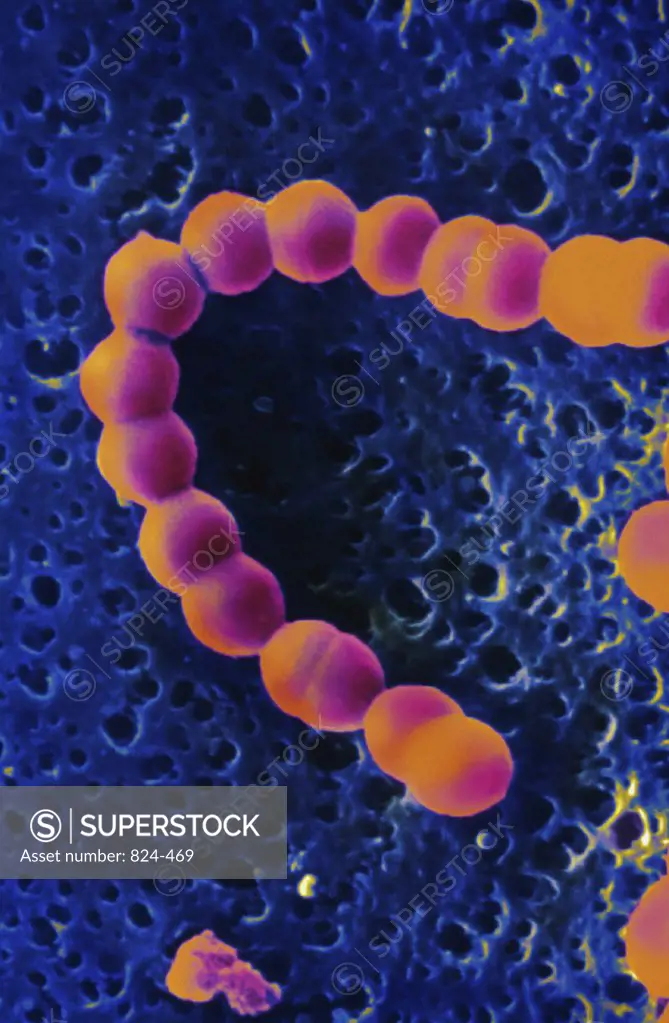 Streptococcus A