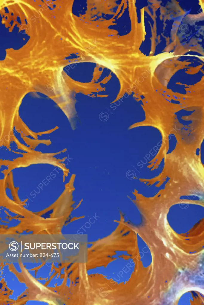 Osteoporotic Bone Tissue